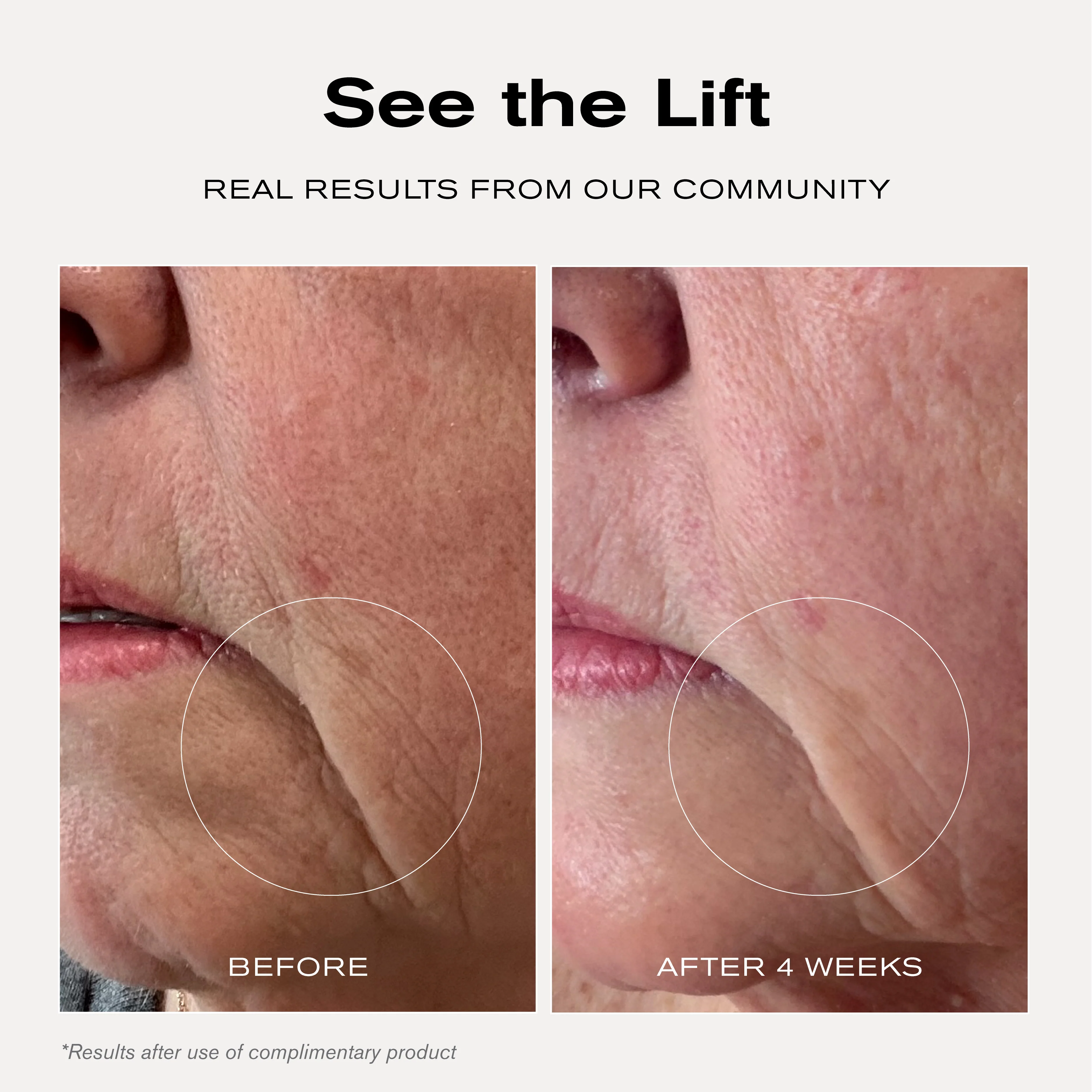 Tightening Treatment Mask - Image 5