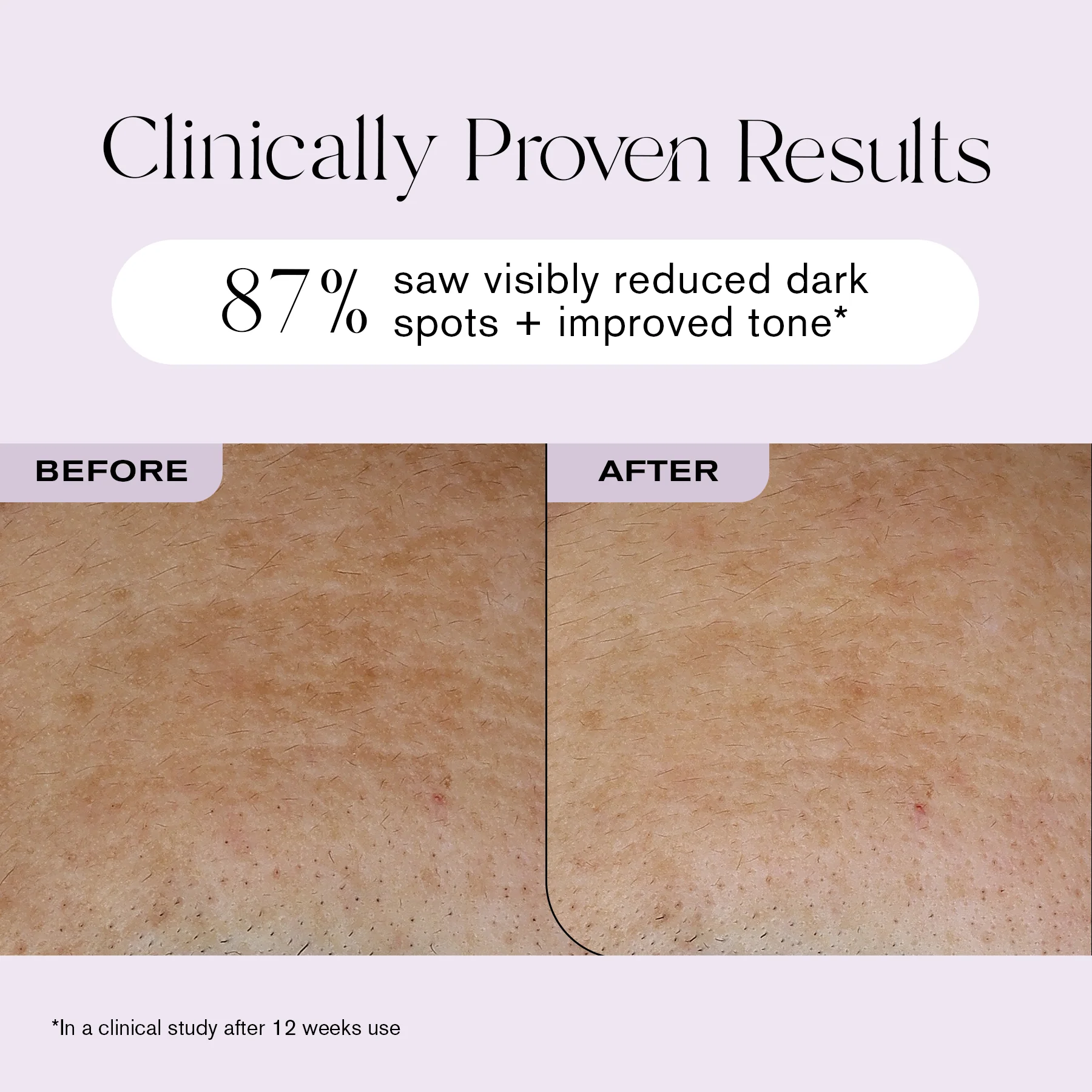 BrightSpot Illuminating Concentrated Treatment - Image 6