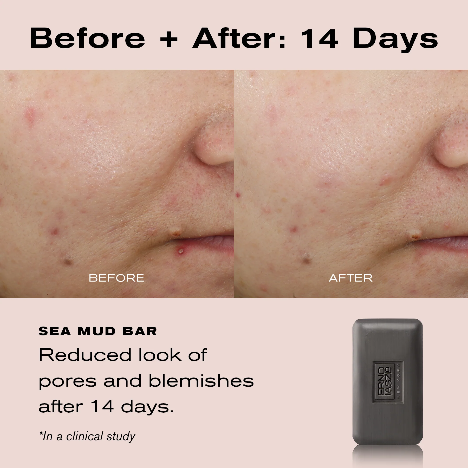 Clarify & Hydrate Cleansing Bar Duo - Image 4
