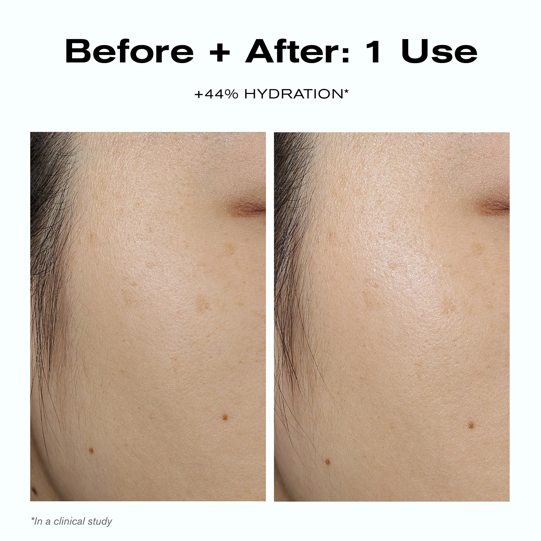 Skin Barrier Duo - Image 4