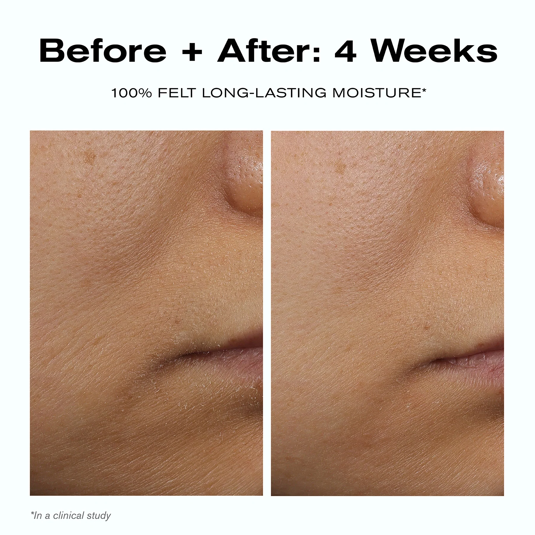 Skin Barrier Duo - Image 5