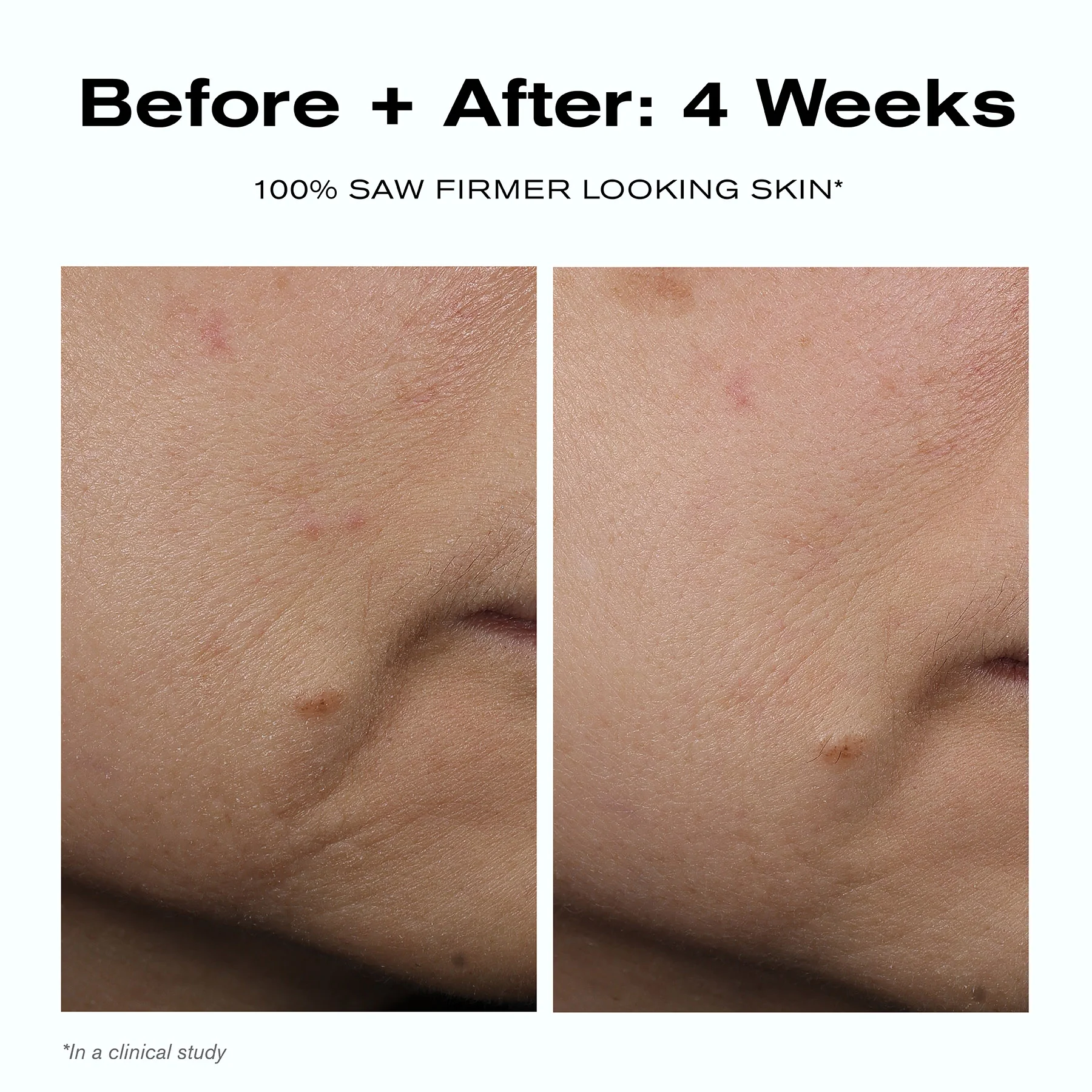 Skin Barrier Duo - Image 6