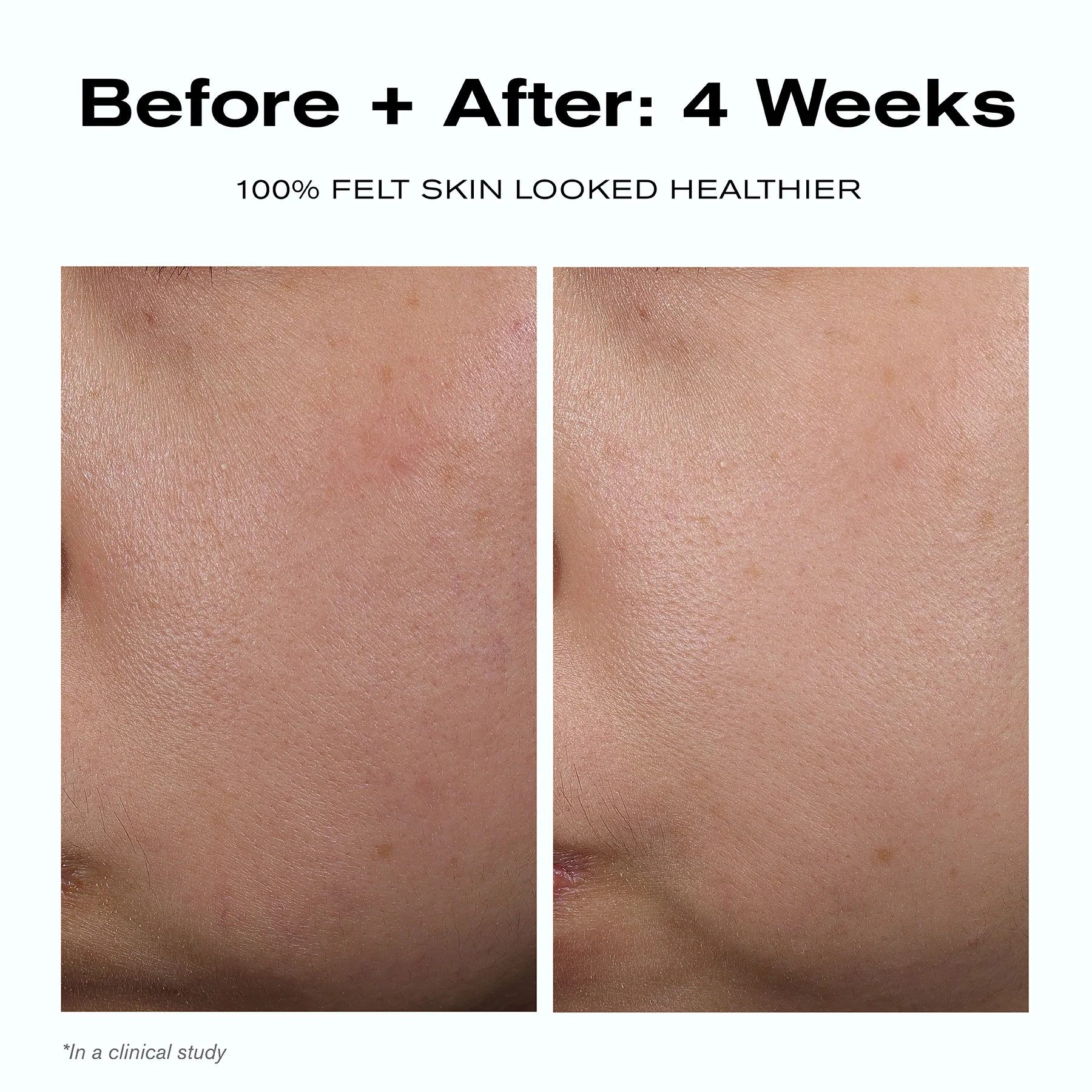 Skin Barrier Duo - Image 7